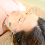 頬のたるみに美容鍼の詳細へ